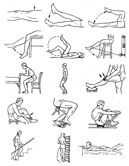 Therapeutic exercises for the osteoarthritis of the knee joint